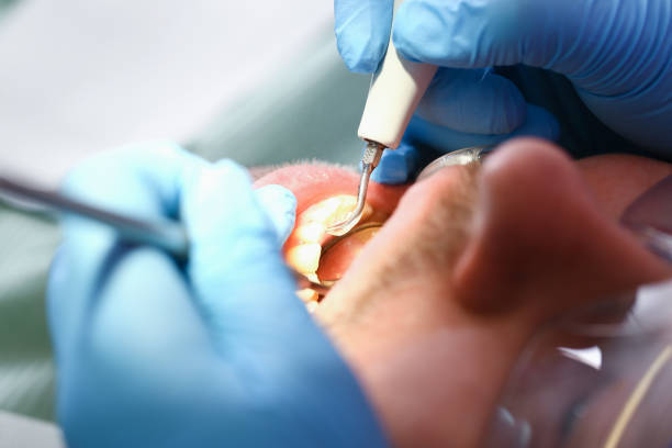 Best Urgent Tooth Repair  in Ripon, WI